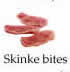 Skinke bites